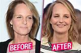Helen Hunt's Facelift Transformation: a Guide to Her Rejuvenated Look
